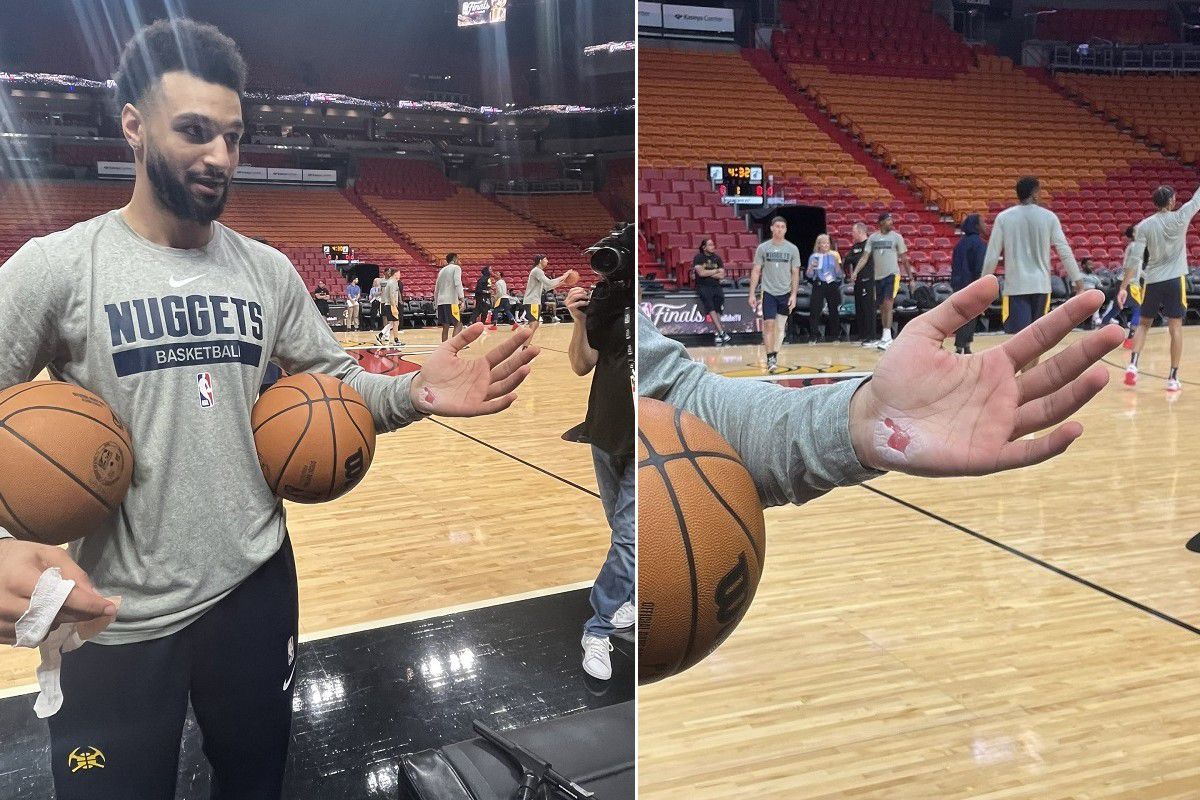 Ο Τζαμάλ Μάρεϊ με έγκαυμα στο χέρι, αλλά με το μυαλό του στη νίκη