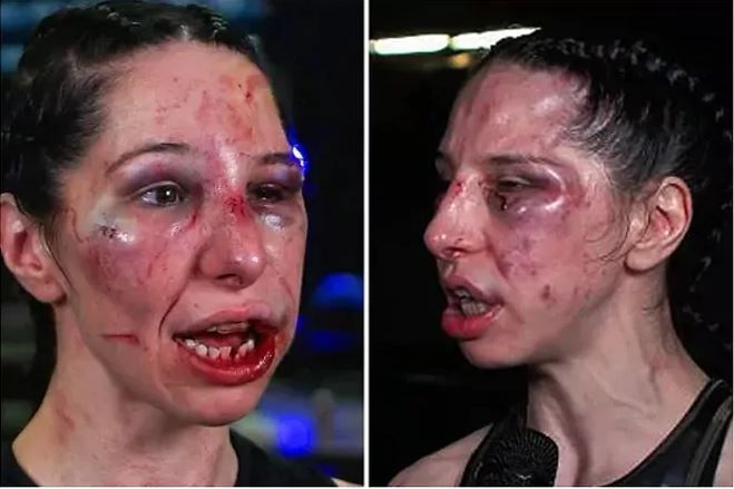 Μελανιασμένη, με βουλωμένα μάτια και σπασμένα δόντια δήλωσε: «Το απόλαυσα»