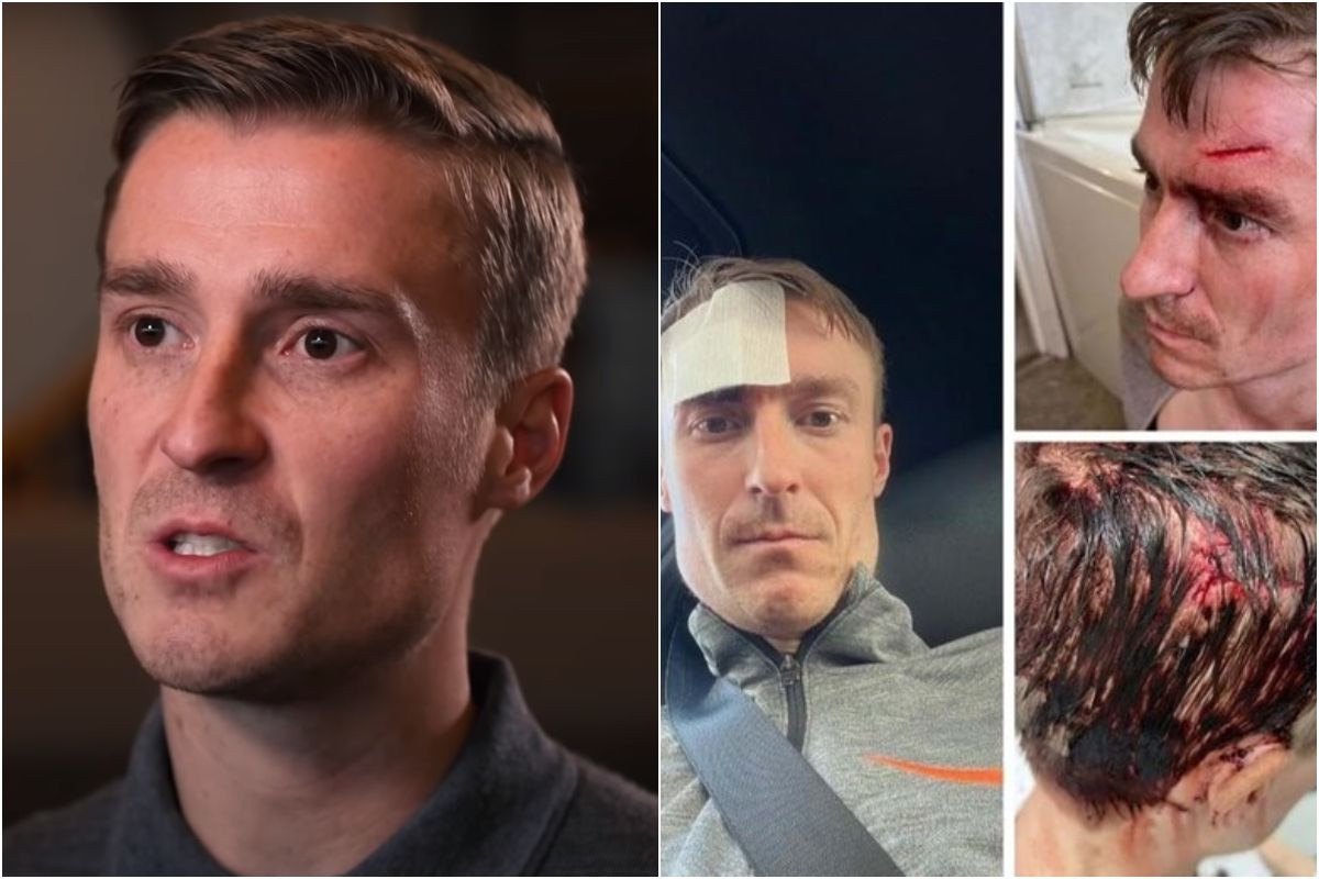 Συγκλονιστικές εικόνες: Πρώην παίκτης της Λίβερπουλ δείχνει πώς είναι να ζεις με εκφυλιστική ασθένεια