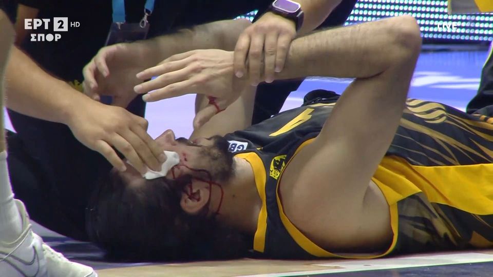 Μάτωσε στο φρύδι ο Κατσίβελης κατά τη διάρκεια του Κολοσσός – ΑΕΚ (vid)