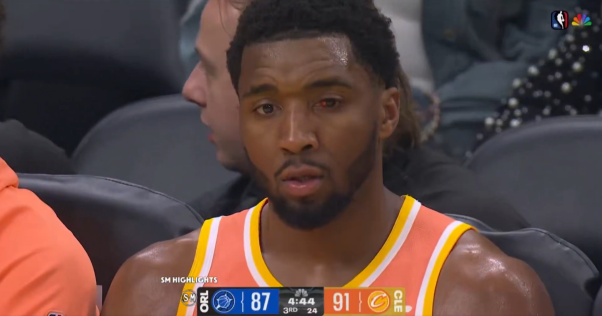 Η αυτοθυσία του Μίτσελ: Σκόραρε 42 πόντους με… ματωμένο μάτι (vid)