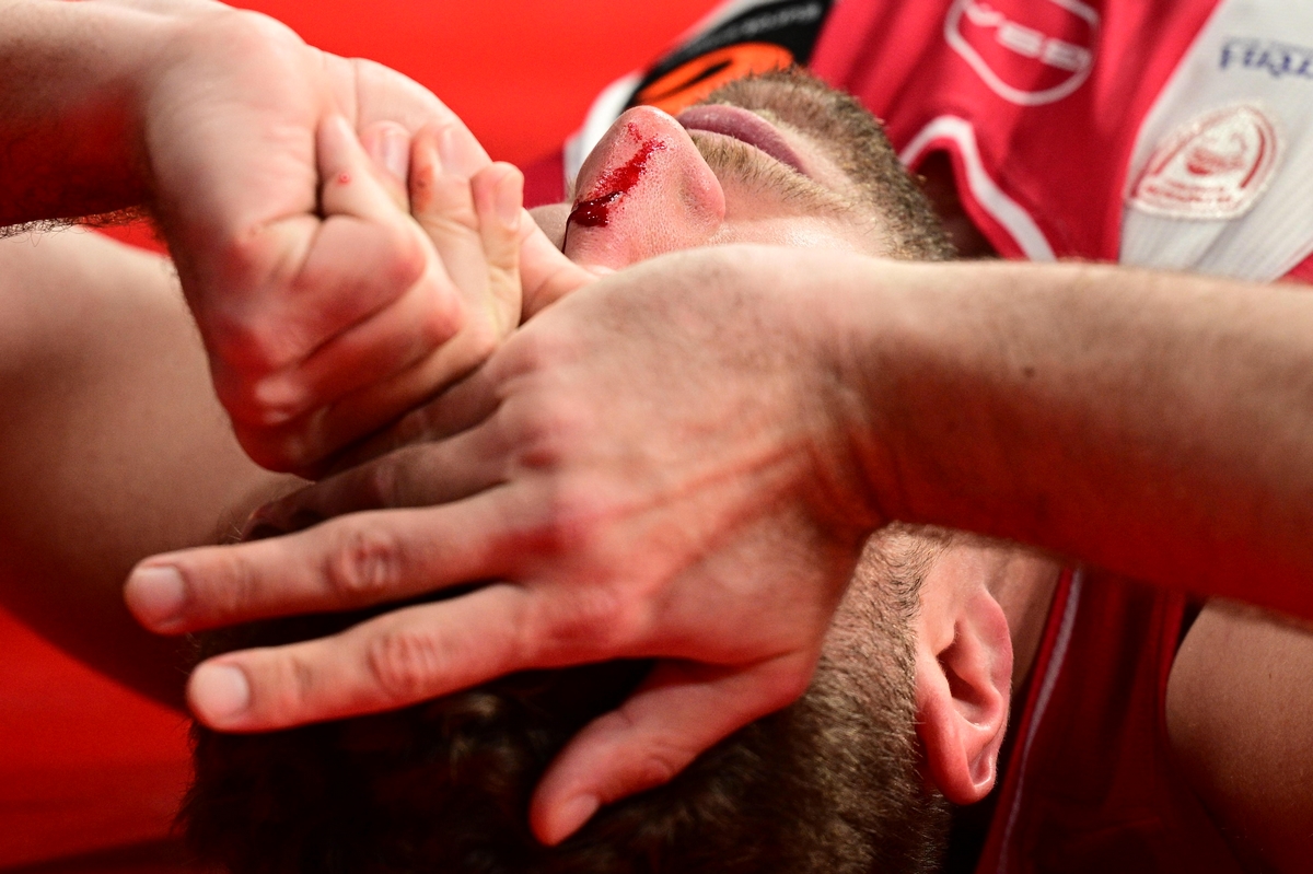 Ολυμπιακός – Μονακό: Ο Ντιαλό χτύπησε και μάτωσε το πρόσωπο του Βεζένκοφ